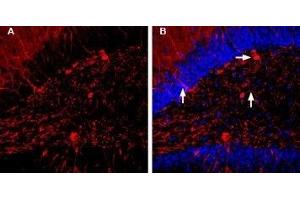 Expression of GABA(A) α1 Receptor in rat hippocampusImmunohistochemical staining of rat hippocampal dentate gyrus sections using Guinea pig Anti-GABA(A) α1 Receptor (extracellular) Antibody (ABIN7043185, ABIN7045422 and ABIN7045423). (gamma-aminobutyric Acid (GABA) A Receptor, alpha 1 (GABRA1) Peptid)