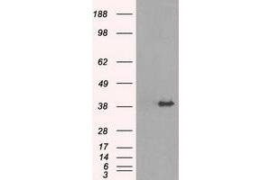 Image no. 1 for anti-Tribbles Pseudokinase 2 (TRIB2) antibody (ABIN1501501) (TRIB2 Antikörper)