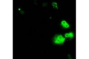 Image no. 14 for anti-Replication Protein A2, 32kDa (RPA2) antibody (ABIN1500735)