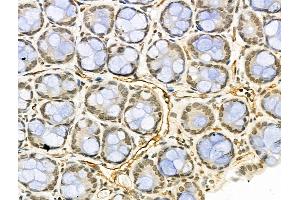 ABIN6264433 and ABIN6276469 at 1/100 staining Rat stomach tissue by IHC-P. (PRMT1 Antikörper  (C-Term))