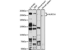 Western blot analysis of extracts of various cell lines, using NUP214 antibody (ABIN6127536, ABIN6144958, ABIN6144959 and ABIN6224385) at 1:1000 dilution. (NUP214 Antikörper  (AA 750-1030))