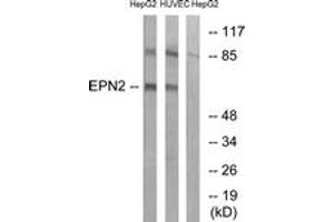 Western blot analysis of extracts from HepG2/HuvEc cells, using EPN2 Antibody. (Epsin 2 Antikörper  (AA 271-320))