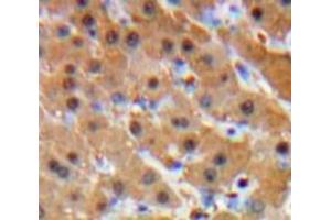 IHC-P analysis of Liver tissue, with DAB staining. (Glucocorticoid Receptor Antikörper  (AA 564-733))