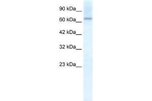 WB Suggested Anti-PIAS2 Antibody Titration:  2. (PIAS2 Antikörper  (C-Term))
