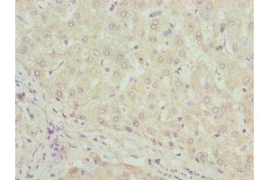 Immunohistochemistry of paraffin-embedded human liver tissue using ABIN7169532 at dilution of 1:100 (DHRS3 Antikörper  (AA 30-169))