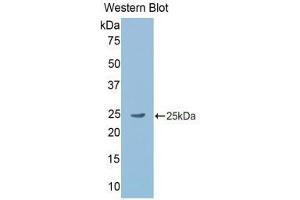 Western Blotting (WB) image for anti-Gastrokine 2 (GKN2) (AA 21-184) antibody (ABIN2117758) (Gastrokine 2 Antikörper  (AA 21-184))