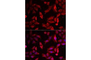 Immunofluorescence (IF) image for anti-serpin Peptidase Inhibitor, Clade B (Ovalbumin), Member 9 (SERPINB9) (AA 1-376) antibody (ABIN6147596)