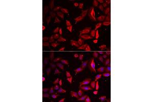 Immunofluorescence analysis of HeLa cells using SERPINB9 antibody. (SERPINB9 Antikörper  (AA 1-376))