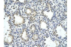 Rabbit Anti-ZNF264 antibody         Paraffin Embedded Tissue:  Human Lung    cell Cellular Data:  alveolar cell    Antibody Concentration:  4. (ZNF264 Antikörper  (N-Term))