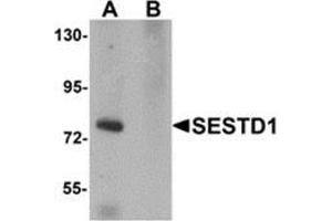 Western blot analysis of SESTD1 in rat brain tissue lysate with SESTD1 antibody at 1 μg/ml in (A) the absence and (B) the presence of blocking peptide. (SESTD1 Antikörper  (C-Term))