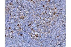 IHC analysis of Axin 2/AXIN2 using anti-Axin 2/AXIN2 antibody (ABIN7602177). (AXIN2 Antikörper  (AA 614-843))