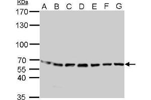 WB Image STIP1 antibody detects STIP1 protein by Western blot analysis. (STIP1 Antikörper)