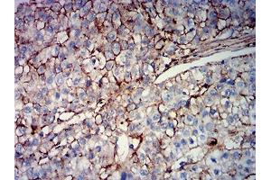 Immunohistochemistry (IHC) image for anti-Mucin 16, Cell Surface Associated (CA125) (AA 1-200) antibody (ABIN7193615)