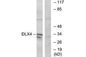 Western blot analysis of extracts from COLO cells, using DLX4 Antibody. (DLX4 Antikörper  (AA 61-110))