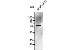 Western Blotting (WB) image for anti-Protein Phosphatase 1, Regulatory Subunit 8 (PPP1R8) antibody (ABIN7272976) (PPP1R8 Antikörper)
