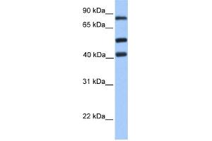 WB Suggested Anti-HCFC2 Antibody Titration:  0. (HCFC2 Antikörper  (C-Term))