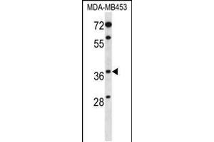 Western blot analysis in MDA-MB453 cell line lysates (35ug/lane). (PAQR8 Antikörper  (C-Term))