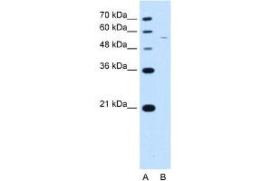 RSRC2 Antikörper  (C-Term)