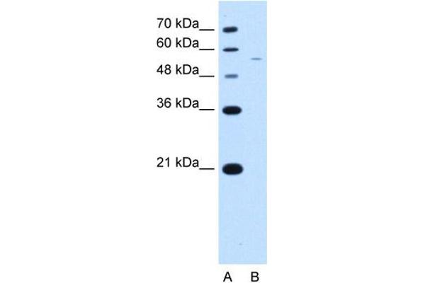 RSRC2 anticorps  (C-Term)