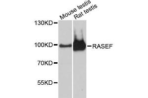 Western blot analysis of extracts of various cell lines, using RASEF antibody (ABIN6293519) at 1:3000 dilution. (RASEF Antikörper)