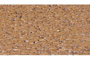Immunohistochemistry (IHC) image for anti-Fatty Acid Binding Protein 3, Muscle and Heart (FABP3) (AA 1-133) antibody (ABIN7433315)