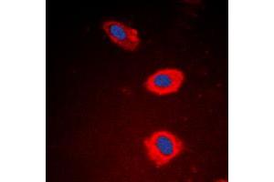 Immunofluorescent analysis of NT5C1B staining in EAhy926 cells.