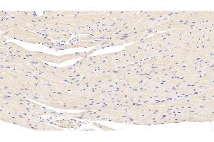 Detection of LEP in Mouse Cardiac Muscle Tissue using Polyclonal Antibody to Leptin (LEP) (Leptin Antikörper  (AA 22-167))