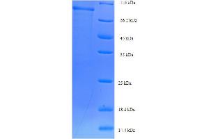 SDS-PAGE (SDS) image for Sorting Nexin 1 (SNX1) (AA 1-522), (full length) protein (His-SUMO Tag) (ABIN5711327) (Sorting Nexin 1 Protein (SNX1) (AA 1-522, full length) (His-SUMO Tag))