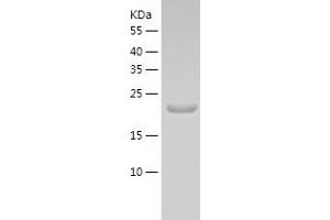 DR1 Protein (AA 1-176) (His tag)