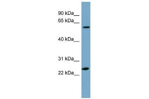 LRRC6 antibody used at 1 ug/ml to detect target protein.