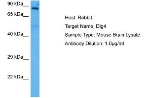 Host: Rabbit Target Name: DLG4 Sample Tissue: Mouse Brain Antibody Dilution: 1ug/ml (DLG4 Antikörper  (Middle Region))