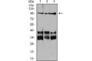Western blot analysis using Neuropilin-1 mouse mAb against Jurkat (1), Hela (2), and HUVEC (3) cell lysate.