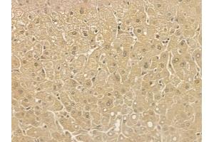 MBNL2 Mouse Monoclonal Antibody at 1/100 staining human normal liver tissue by IHC-P. (MBNL2 Antikörper)