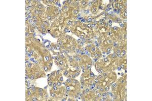 Immunohistochemistry of paraffin-embedded rat kidney using PSMD5 antibody (ABIN5975452) at dilution of 1/100 (40x lens). (PSMD5 Antikörper)