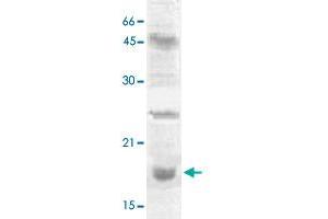 The nuclear extract derived from NIH/3T3 were immunoprecipitated by 4 ug of HIST2H3C polyclonal antibody , then probed with HIST2H3C polyclonal antibody  at 1 : 1000. (Histone Cluster 2, H3c (HIST2H3C) (Lys27) Antikörper)