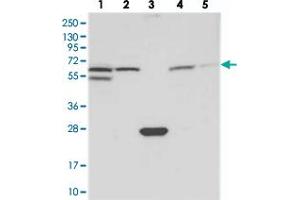Western blot analysis of Lane 1: RT-4, Lane 2: U-251 MG, Lane 3: Human Plasma, Lane 4: Liver, Lane 5: Tonsil with SPATA18 polyclonal antibody . (SPATA18 Antikörper)