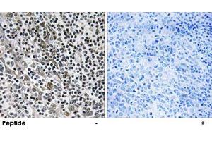 Immunohistochemistry analysis of paraffin-embedded human tonsil tissue using MRPL51 polyclonal antibody . (MRPL51 Antikörper)