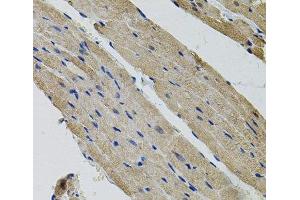 Immunohistochemistry of paraffin-embedded Rat heart using ALDH9A1 Polyclonal Antibody (ALDH9A1 Antikörper)