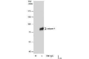 IP Image Immunoprecipitation of Calpain 1 protein from A431 whole cell extracts using 5 μg of Calpain 1 antibody [N3C2], Internal, Western blot analysis was performed using Calpain 1 antibody [N3C2], Internal, EasyBlot anti-Rabbit IgG  was used as a secondary reagent. (CAPN1 Antikörper)