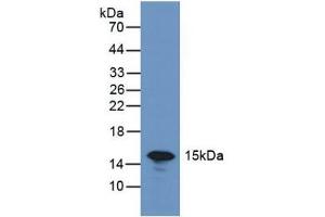 Detection of GAL7 in Rat Skin Tissue using Polyclonal Antibody to Galectin 7 (GAL7) (LGALS7 Antikörper  (AA 1-136))