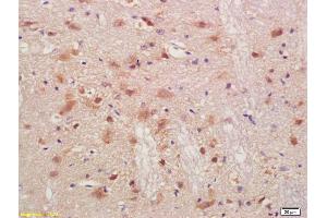 Formalin-fixed and paraffin embedded rat brain labeled with Anti-PMP2 Polyclonal Antibody, Unconjugated (ABIN676823) at 1:200, followed by conjugation to the secondary antibody and DAB staining (PMP2 Antikörper  (AA 31-132))