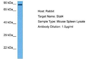 Host: Rabbit Target Name: STAT4 Sample Tissue: Mouse Spleen Antibody Dilution: 1ug/ml (STAT4 Antikörper  (N-Term))