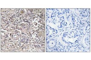 Immunohistochemistry analysis of paraffin-embedded human ovary tissue using CLDN6 antibody. (Claudin 6 Antikörper  (Internal Region))