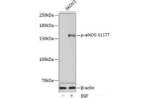 Western blot analysis of extracts of SKOV3 cells using Phospho-eNOS(S1177) Polyclonal Antibody.