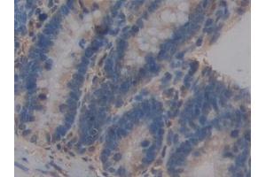 Immunohistochemistry (IHC) image for anti-Intercellular Adhesion Molecule 2 (ICAM2) (AA 29-247) antibody (ABIN7442924)