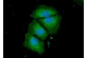 ICC/IF analysis of ACSF2 in HeLa cells line, stained with DAPI (Blue) for nucleus staining and monoclonal anti-human ACSF2 antibody (1:100) with goat anti-mouse IgG-Alexa fluor 488 conjugate (Green) (ACSF2 Antikörper)