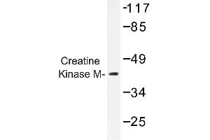 Image no. 1 for anti-Creatine Kinase, Muscle (CKM) antibody (ABIN272157) (CKM Antikörper)