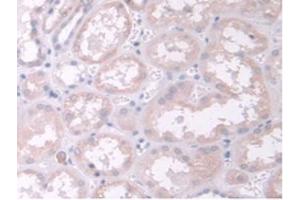 IHC-P analysis of Human Kidney Tissue, with DAB staining. (TPMT Antikörper  (AA 26-227))