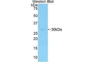 Western blot analysis of the recombinant protein. (MYO1G Antikörper  (AA 769-1016))