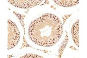 Immunohistochemistry analysis of paraffin-embedded mouse testis using,DAZAP1 (ABIN7073691) at dilution of 1: 6000 (DAZAP1 Antikörper)